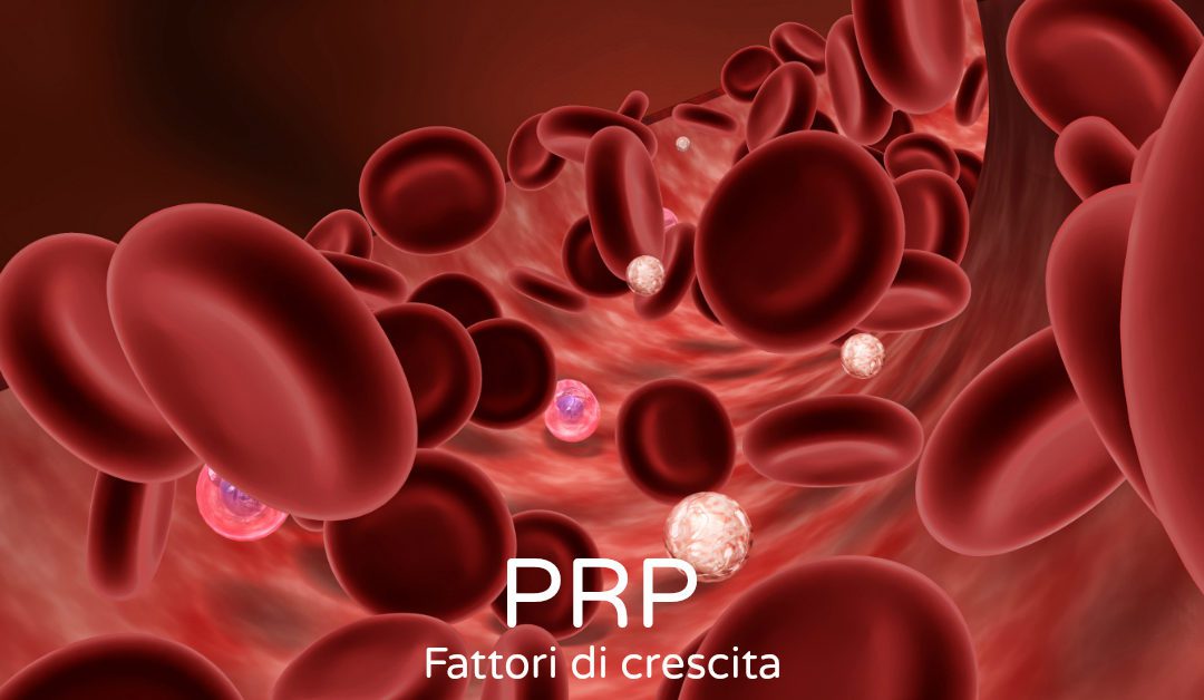 La PRP efficace per la cura e la ricrescita dei capelli