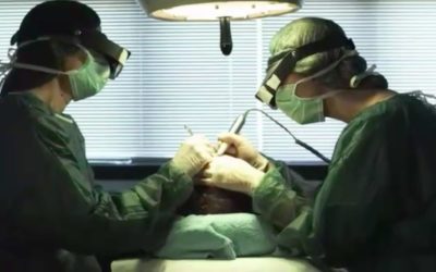 Il trapianto di capelli come soluzione efficace per il problema della calvizie