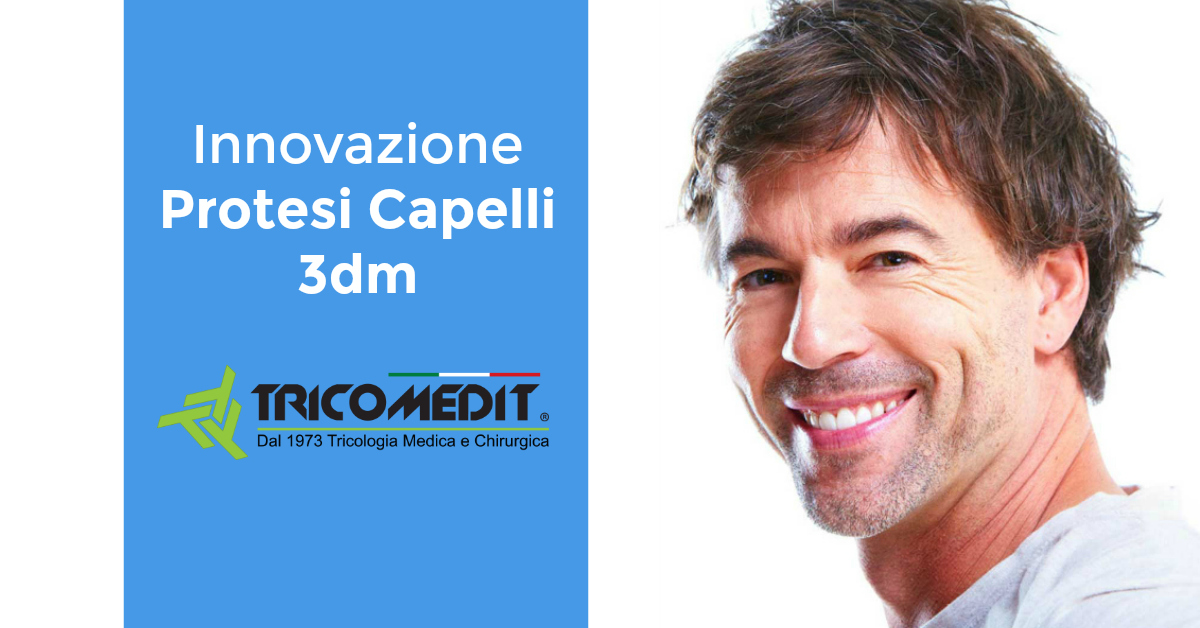 Protesi Capelli 3dm