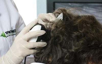 Perchè è importante effettuare un esame tricologico