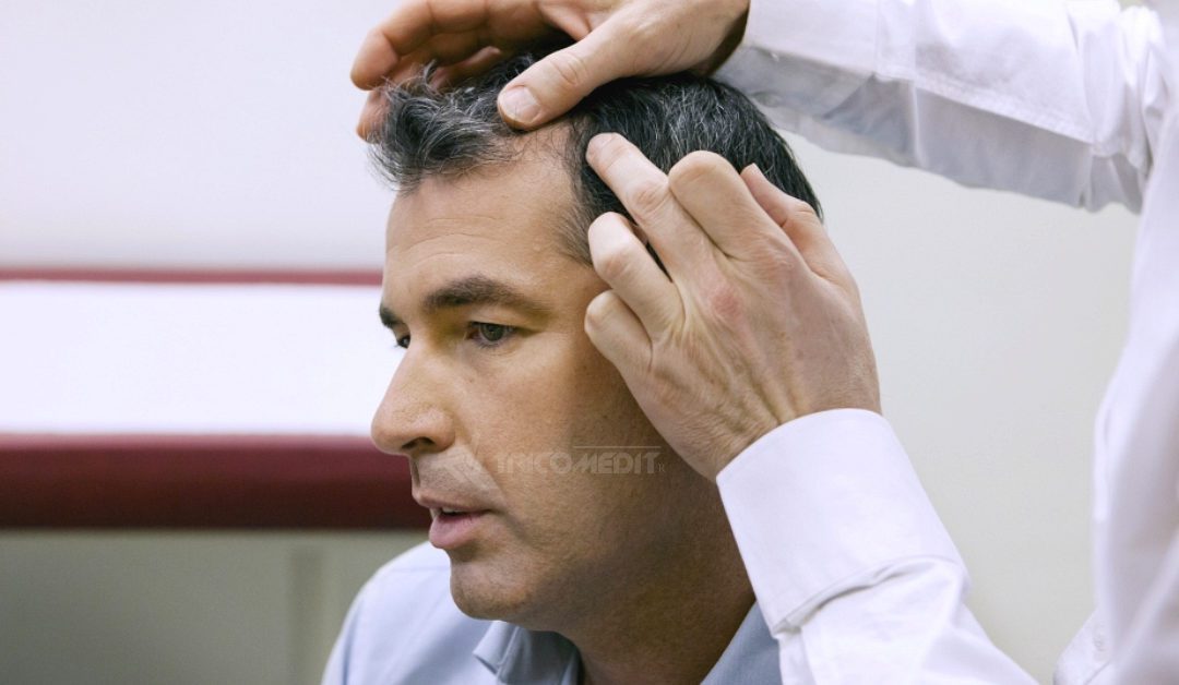 Cure anticaduta per capelli