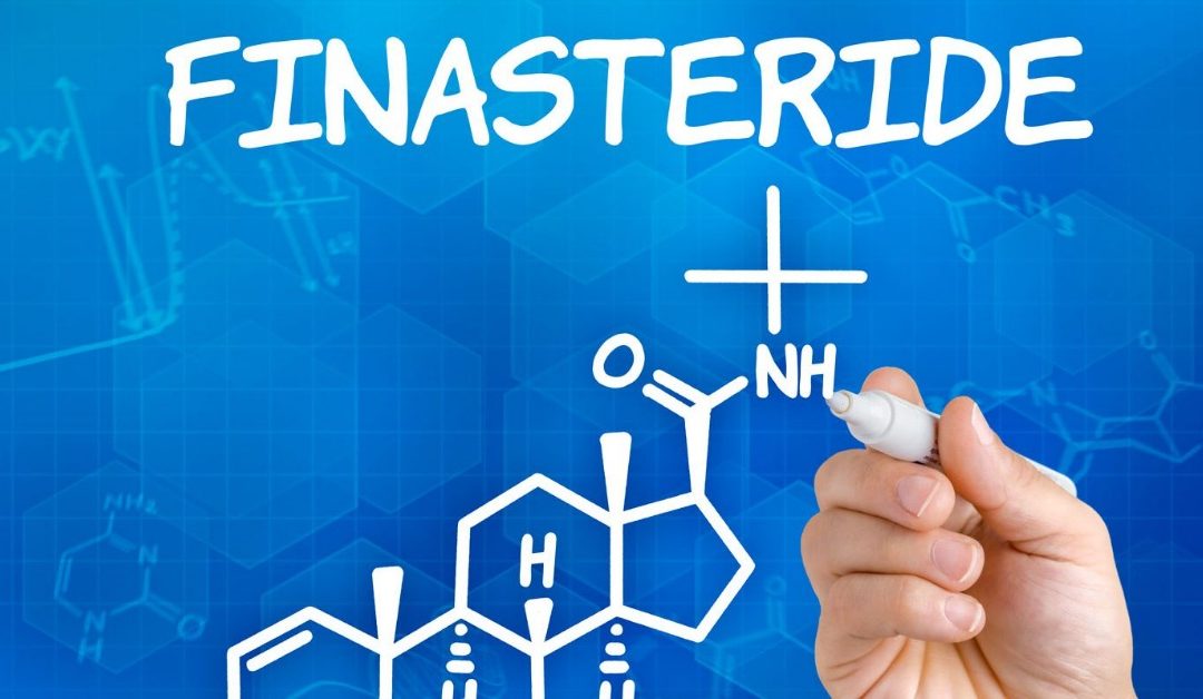 Finasteride nelle cure anticaduta