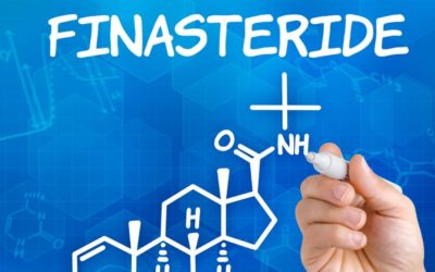 Finasteride nelle cure anticaduta