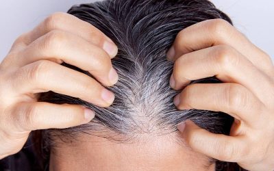 Perché vengono i capelli bianchi