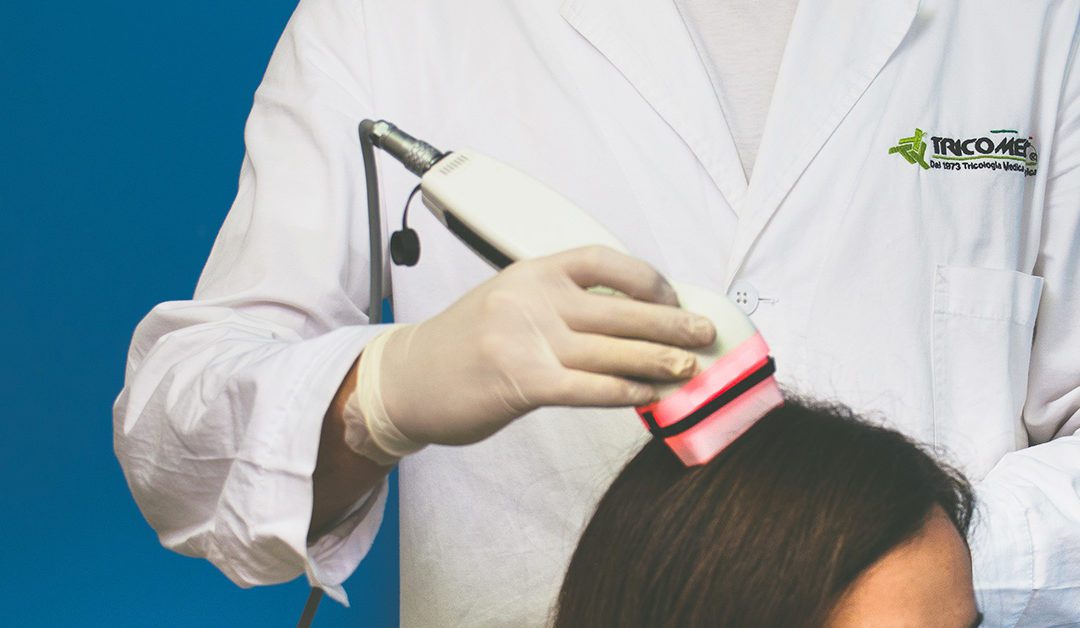 La terapia laser per capelli funziona?