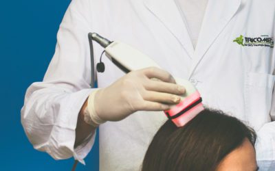 La terapia laser per capelli funziona?