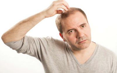 Cura per l’alopecia androgenetica maschile