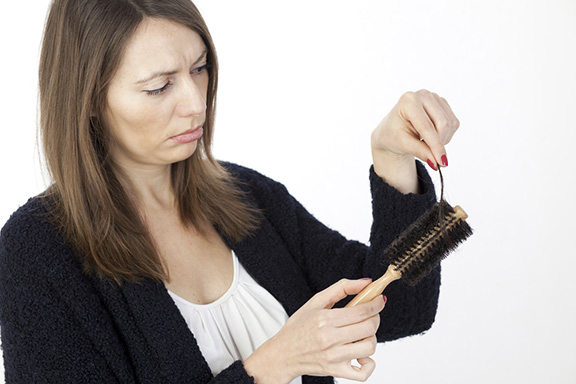 Caduta capelli donne