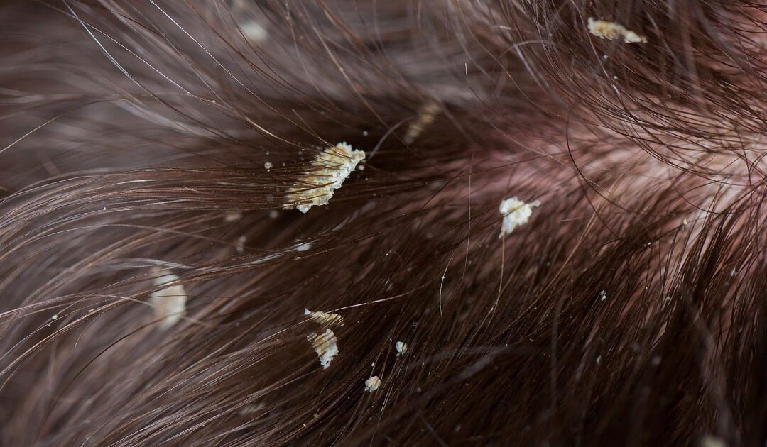 Forfora grassa, come riconoscerla e come curarla