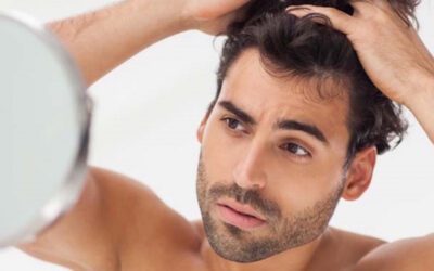 Caduta dei capelli: le principali cause