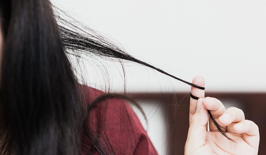Tricotillomania: sintomi, cause e soluzioni