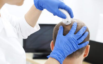 Covid e caduta dei capelli