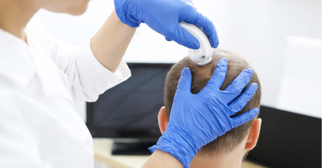 Covid e caduta dei capelli