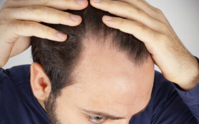 Stempiatura e diradamento capelli