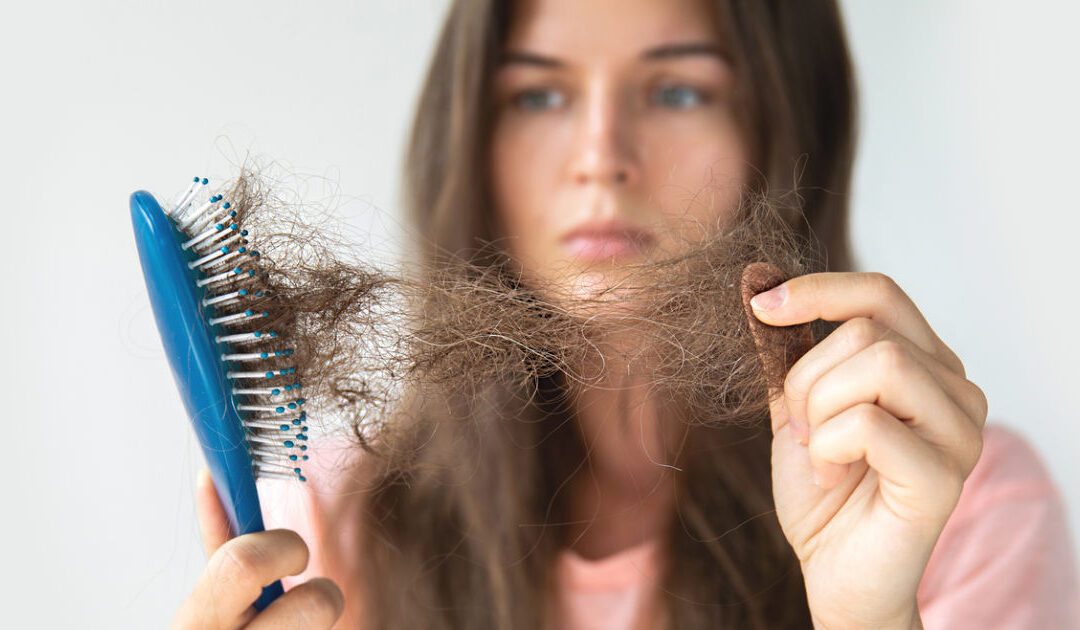 Come riconoscere un telogen effluvium e cosa fare