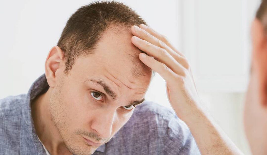 Stempiatura dei capelli nell’uomo