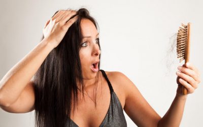 Cos’è l’alopecia femminile?