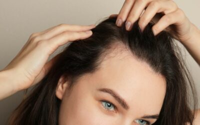 Stempiatura nelle donne: comprensione e gestione