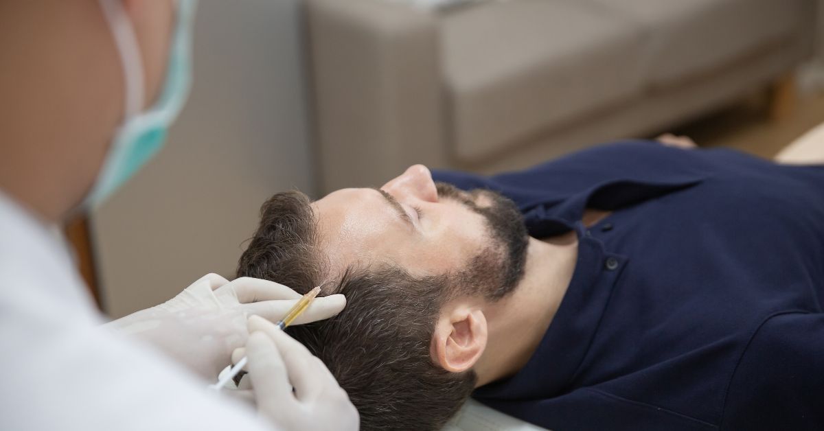 PRP capelli prima e dopo