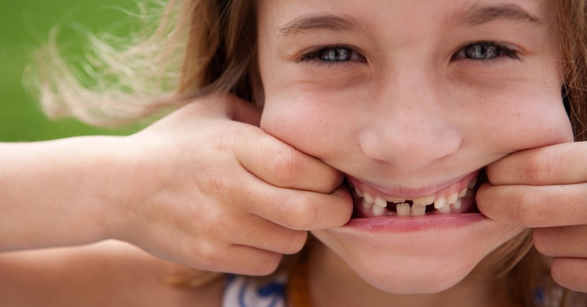 Sognare di perdere i denti