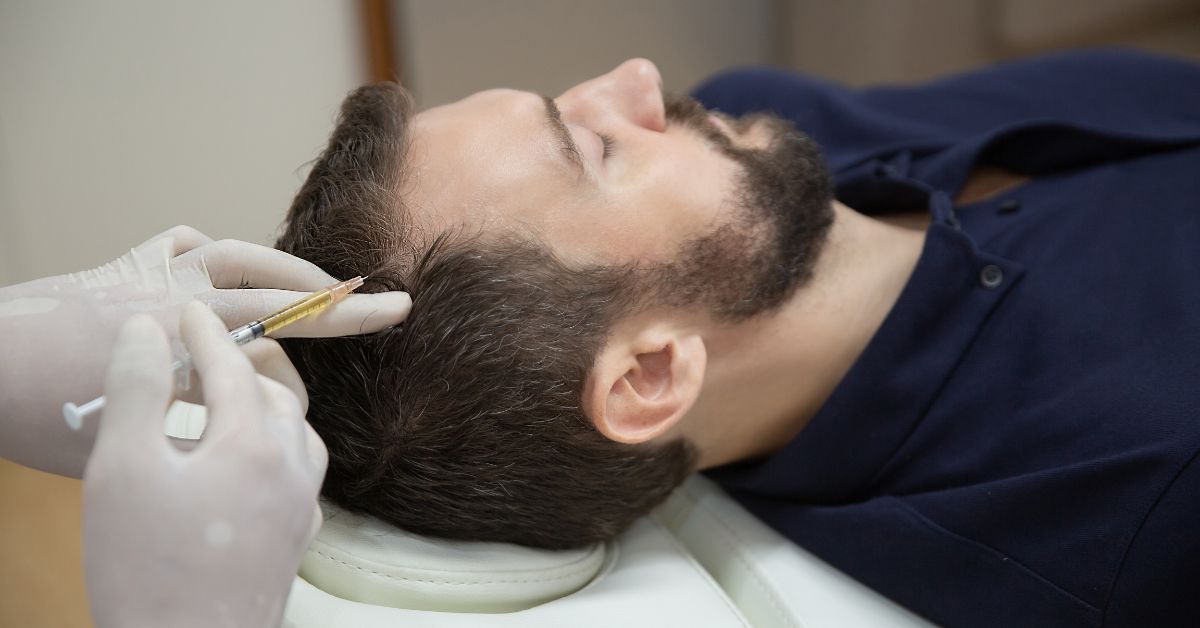 PRP biologico trattamento anticaduta
